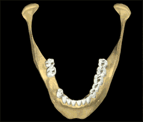 Bone Regeneration animation
