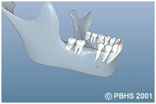 Dental Implants Animation